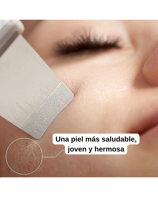 Espátula Facial Ultrasónica 3 en 1 | Limpieza Profunda, Puntos Negros y Lifting